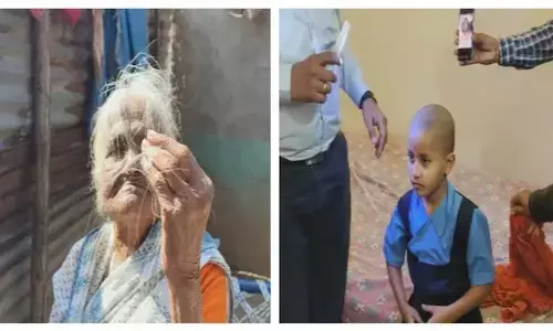 ಮಹಾರಾಷ್ಟ್ರ | ಮೂರು ಹಳ್ಳಿಗಳ ಜನರಲ್ಲಿ ಕಾಣಿಸಿಕೊಂಡ ಹಠಾತ್ ಕೂದಲು ಉದುರುವಿಕೆ!