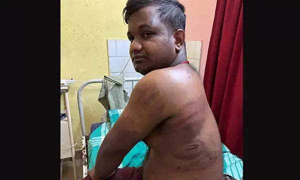 ಉಡುಪಿ| ಯಕ್ಷಗಾನ ಕಲಾವಿದನಿಗೆ ಮನೆಯಲ್ಲಿ ಕೂಡಿ ಹಾಕಿ ಹಲ್ಲೆ: ಪ್ರಕರಣ ದಾಖಲು