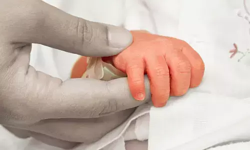 ಅಮೆರಿಕ: ಪೌರತ್ವಕ್ಕೆ ಸಂಬಂಧಿಸಿದ ಕಾರ್ಯಾದೇಶದಿಂದ ಪಾರಾಗಲು ಸಿಸೇರಿಯನ್ ಗೆ ಮೊರೆ!