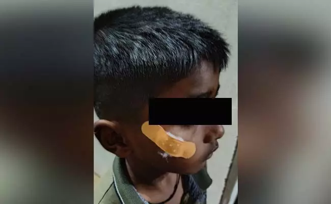 ಹಾವೇರಿ| ಬಾಲಕನ ಗಾಯಕ್ಕೆ ಫೆವಿಕ್ವಿಕ್‌ ಹಾಕಿದ ನರ್ಸ್:‌ ಆರೋಪ