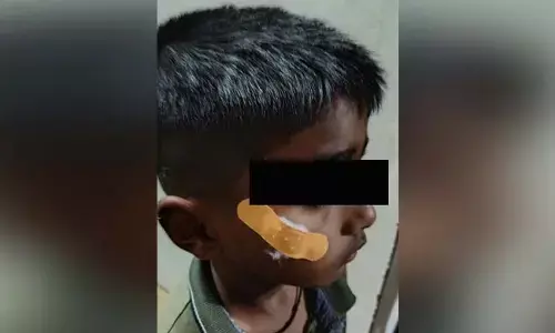 ಹಾವೇರಿ| ಬಾಲಕನ ಗಾಯಕ್ಕೆ ಫೆವಿಕ್ವಿಕ್‌ ಹಾಕಿದ ನರ್ಸ್:‌ ಆರೋಪ