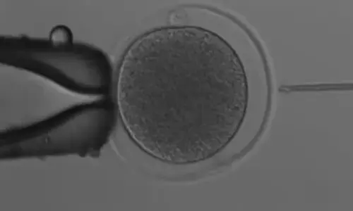 ಆಸ್ಟ್ರೇಲಿಯಾ | ಐವಿಎಫ್ ಮೂಲಕ ಕಾಂಗರೂ ಭ್ರೂಣ ರಚನೆ!