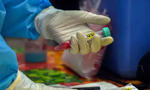 ಆಂಧ್ರಪ್ರದೇಶ: ಜಿಬಿಎಸ್‌ ಗೆ 10 ದಿನಗಳಲ್ಲಿ ಇಬ್ಬರು ಬಲಿ