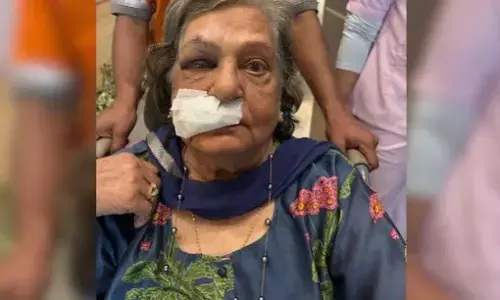 ವ್ಹೀಲ್ ಚೇರ್ ನಿರಾಕರಿಸಿದ ಏರ್ ಇಂಡಿಯಾ ಸಿಬ್ಬಂದಿ: ಬಿದ್ದು ಆಸ್ಪತ್ರೆ ಸೇರಿದ 82ರ ವೃದ್ಧೆ!