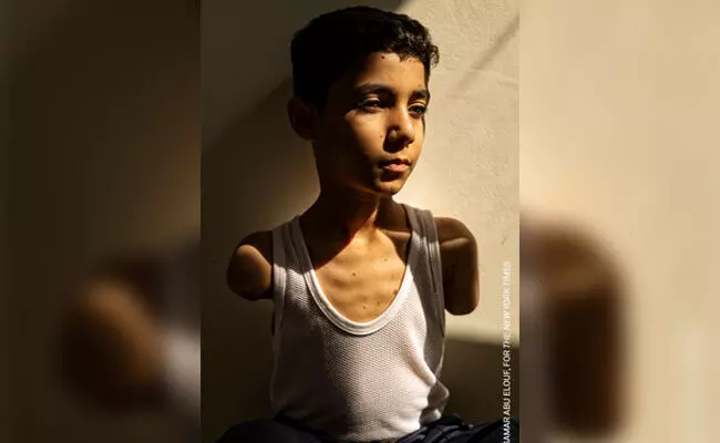 ಎರಡೂ ಕೈಗಳನ್ನು ಕಳೆದುಕೊಂಡ ಫೆಲೆಸ್ತೀನಿನ ಬಾಲಕನ ಚಿತ್ರಕ್ಕೆ ʼವರ್ಲ್ಡ್ ಫೊಟೋ ಆಫ್ ದ ಇಯರ್ʼ ಗೌರವ ಎರಡೂ ಕೈಗಳನ್ನು ಕಳೆದುಕೊಂಡ ಫೆಲೆಸ್ತೀನಿನ ಬಾಲಕನ ಚಿತ್ರಕ್ಕೆ ʼವರ್ಲ್ಡ್ ಫೊಟೋ ಆಫ್ ದ ಇಯರ್ʼ ಗೌರವ