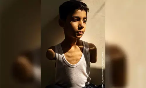 ಎರಡೂ ಕೈಗಳನ್ನು ಕಳೆದುಕೊಂಡ ಫೆಲೆಸ್ತೀನಿನ ಬಾಲಕನ ಚಿತ್ರಕ್ಕೆ ʼವರ್ಲ್ಡ್ ಫೊಟೋ ಆಫ್ ದ ಇಯರ್ʼ ಗೌರವ