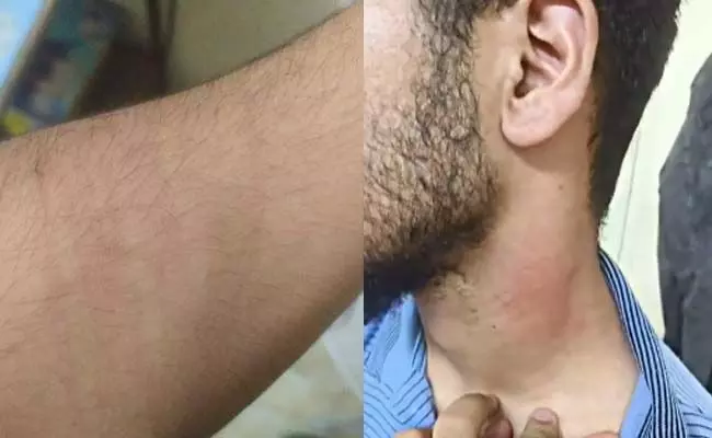 ನಾಗ್ಪುರದಲ್ಲಿ ಜಮ್ಮುಕಾಶ್ಮೀರದ ವಿದ್ಯಾರ್ಥಿ ಮೇಲೆ ಹಲ್ಲೆ