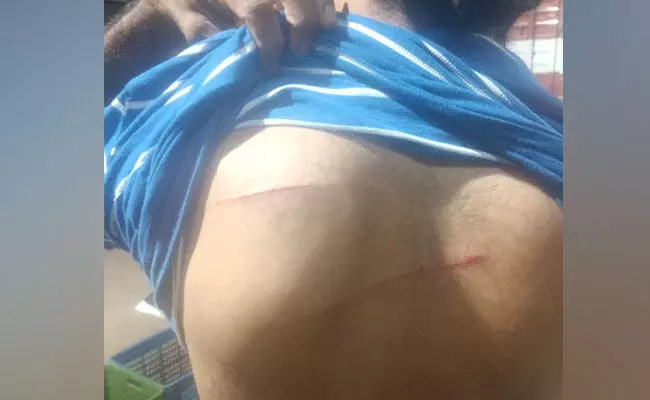 ಉಳ್ಳಾಲ: ಯುವಕನ ಮೇಲೆ ಮಾರಕಾಸ್ತ್ರದಿಂದ ದಾಳಿ