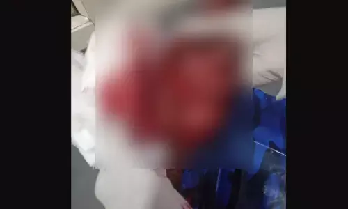 ಬಂಟ್ವಾಳ: ಯುವಕನಿಗೆ ತಂಡದಿಂದ ಚೂರಿ ಇರಿತ