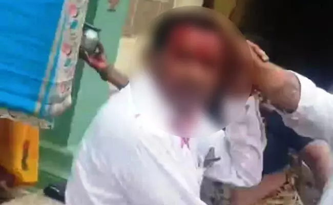 ಕಲಬುರಗಿ | ವರದಕ್ಷಿಣೆ ತರದಿದ್ದಕ್ಕೆ ಬೀದಿಯಲ್ಲೇ ಪತ್ನಿ, ಮಾವನಿಗೆ ಆಳಿಯನಿಂದ ಮಾರಣಾಂತಿಕ ಹಲ್ಲೆ; ಪ್ರಕರಣ ದಾಖಲು ಕಲಬುರಗಿ | ವರದಕ್ಷಿಣೆ ತರದಿದ್ದಕ್ಕೆ ಬೀದಿಯಲ್ಲೇ ಪತ್ನಿ, ಮಾವನಿಗೆ ಆಳಿಯನಿಂದ ಮಾರಣಾಂತಿಕ ಹಲ್ಲೆ; ಪ್ರಕರಣ ದಾಖಲು