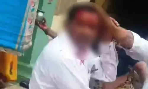 ಕಲಬುರಗಿ | ವರದಕ್ಷಿಣೆ ತರದಿದ್ದಕ್ಕೆ ಬೀದಿಯಲ್ಲೇ ಪತ್ನಿ, ಮಾವನಿಗೆ ಆಳಿಯನಿಂದ ಮಾರಣಾಂತಿಕ ಹಲ್ಲೆ; ಪ್ರಕರಣ ದಾಖಲು