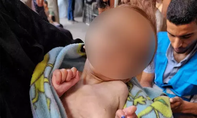 ಗಾಝಾದಲ್ಲಿ ಪ್ರತಿ 10ರಲ್ಲಿ 1 ಮಗುವಿಗೆ ಅಪೌಷ್ಟಿಕತೆ: ವಿಶ್ವಸಂಸ್ಥೆಯ ನಿರಾಶ್ರಿತರ ಸಂಸ್ಥೆ