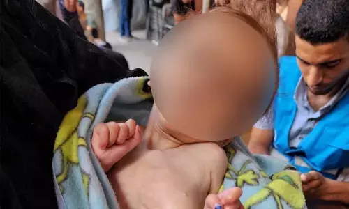 ಗಾಝಾದಲ್ಲಿ ಪ್ರತಿ 10ರಲ್ಲಿ 1 ಮಗುವಿಗೆ ಅಪೌಷ್ಟಿಕತೆ: ವಿಶ್ವಸಂಸ್ಥೆಯ ನಿರಾಶ್ರಿತರ ಸಂಸ್ಥೆ