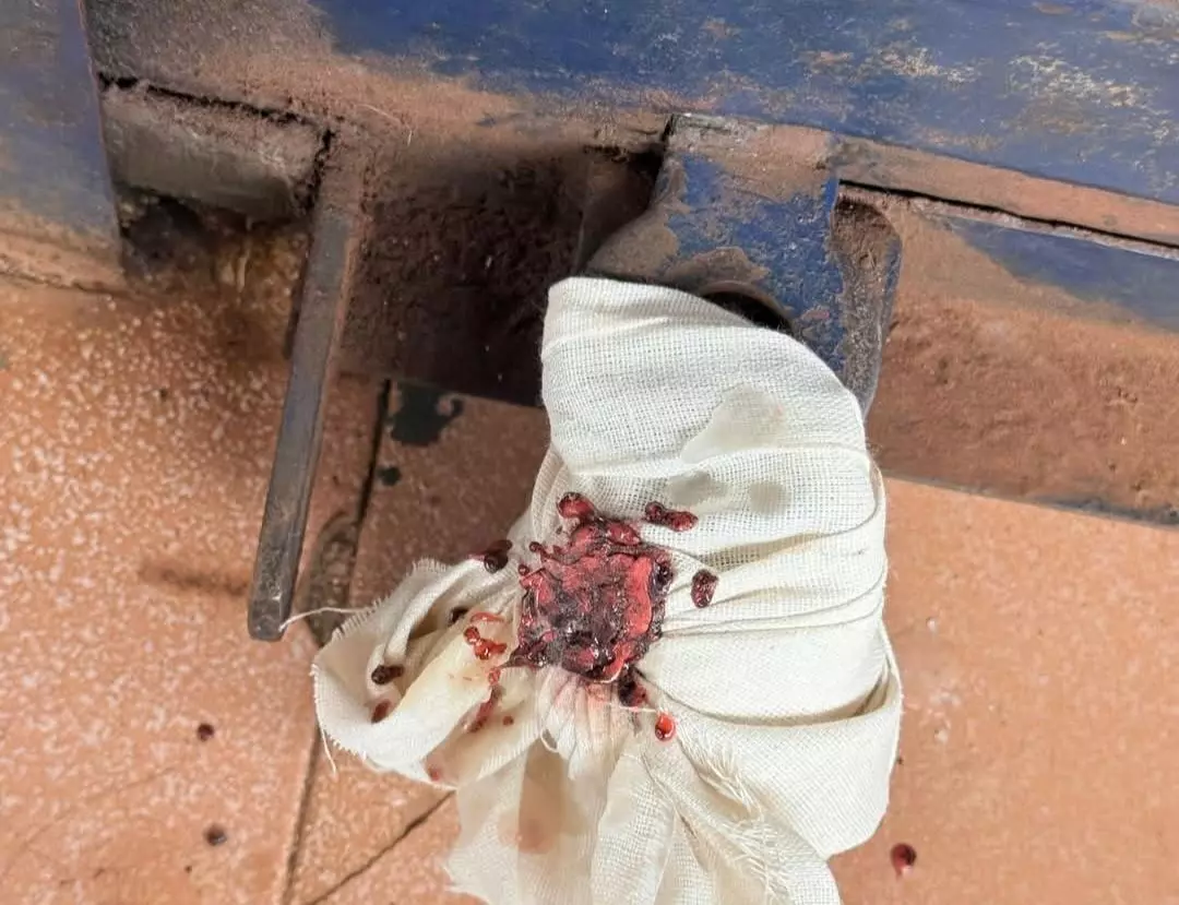 ಮಂಗಳೂರು, ದೇರಳಕಟ್ಟೆ: ನಾಲ್ಕು ಕ್ಲಿನಿಕ್ಗಳ ಮೇಲೆ ಆರೋಗ್ಯ ಇಲಾಖೆ ದಾಳಿ ಮಂಗಳೂರು, ದೇರಳಕಟ್ಟೆ: ನಾಲ್ಕು ಕ್ಲಿನಿಕ್ಗಳ ಮೇಲೆ ಆರೋಗ್ಯ ಇಲಾಖೆ ದಾಳಿ