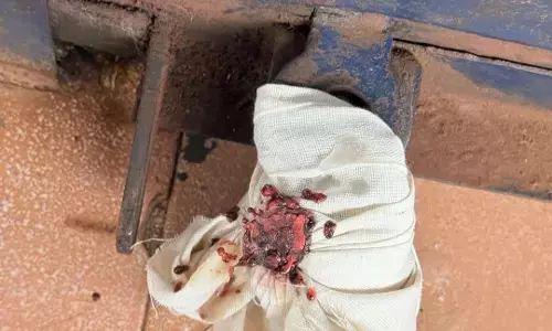 ಮಂಗಳೂರು, ದೇರಳಕಟ್ಟೆ: ನಾಲ್ಕು ಕ್ಲಿನಿಕ್‌ಗಳ ಮೇಲೆ ಆರೋಗ್ಯ ಇಲಾಖೆ ದಾಳಿ