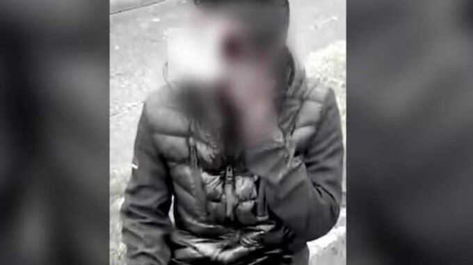 ಐರ್ಲೆಂಡ್‌ನಲ್ಲಿ ಭಾರತೀಯನ ಬಟ್ಟೆ ಬಿಚ್ಚಿಸಿ ಗುಂಪು ಹಲ್ಲೆ