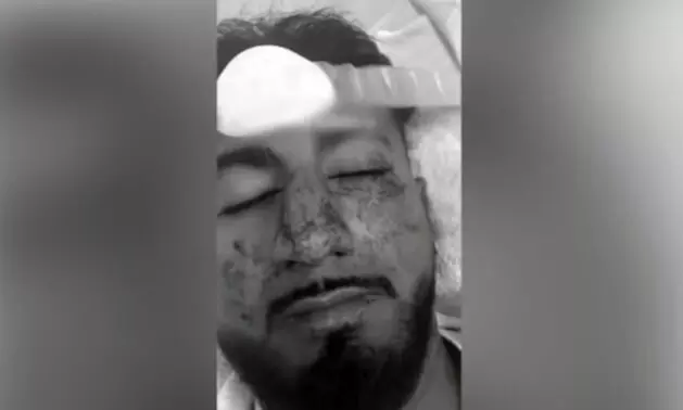 ಆಸ್ಟ್ರೇಲಿಯಾ: ಭಾರತೀಯನ ಮೇಲೆ ಜನಾಂಗೀಯ ನಿಂದನೆ, ಗುಂಪು ಹಲ್ಲೆ