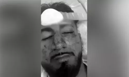 ಆಸ್ಟ್ರೇಲಿಯಾ: ಭಾರತೀಯನ ಮೇಲೆ ಜನಾಂಗೀಯ ನಿಂದನೆ, ಗುಂಪು ಹಲ್ಲೆ