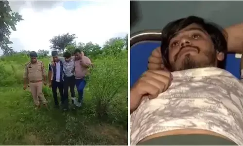 ಉತ್ತರ ಪ್ರದೇಶ | ವರದಕ್ಷಿಣೆಗಾಗಿ ಮಹಿಳೆಯನ್ನು ಬೆಂಕಿ ಹಚ್ಚಿ ಕೊಲೆ ಪ್ರಕರಣ : ಆರೋಪಿಯ ಕಾಲಿಗೆ ಗುಂಡಿಕ್ಕಿದ ಪೊಲೀಸರು