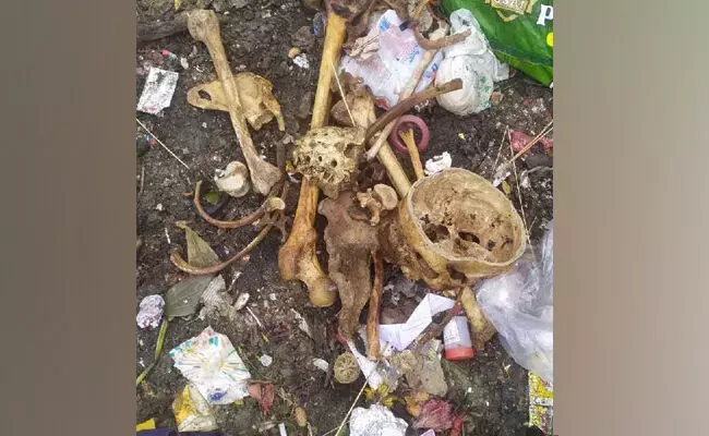 ಬೆಂಗಳೂರು | ಕಸದ ರಾಶಿಯಲ್ಲಿ ಮನುಷ್ಯನ ಮೂಳೆಗಳು ಪತ್ತೆ!