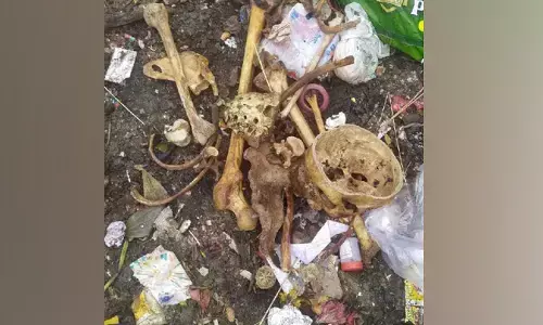 ಬೆಂಗಳೂರು | ಕಸದ ರಾಶಿಯಲ್ಲಿ ಮನುಷ್ಯನ ಮೂಳೆಗಳು ಪತ್ತೆ!