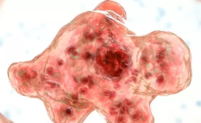 ಕೇರಳ: ಮೆದುಳು ಸೋಂಕಿಗೆ ಮತ್ತೋರ್ವ ಬಲಿ