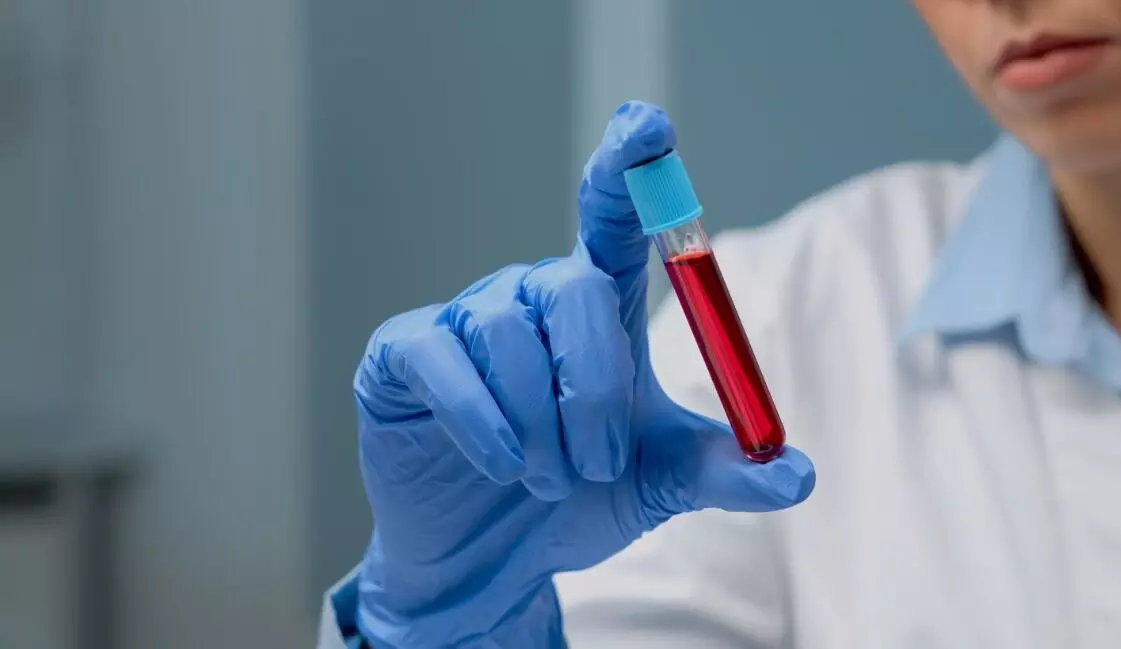 ಮಧ್ಯಪ್ರದೇಶ | ಭೋಪಾಲ್ ಏಮ್ಸ್ ಆಸ್ಪತ್ರೆಯಿಂದ ರಕ್ತ, ಪ್ಲಾಸ್ಮಾ ಕಳವು : ತನಿಖೆಗೆ ಆದೇಶ