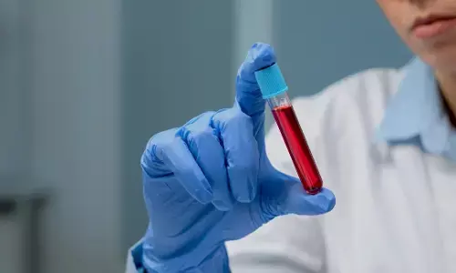 ಮಧ್ಯಪ್ರದೇಶ | ಭೋಪಾಲ್ ಏಮ್ಸ್ ಆಸ್ಪತ್ರೆಯಿಂದ ರಕ್ತ, ಪ್ಲಾಸ್ಮಾ ಕಳವು : ತನಿಖೆಗೆ ಆದೇಶ