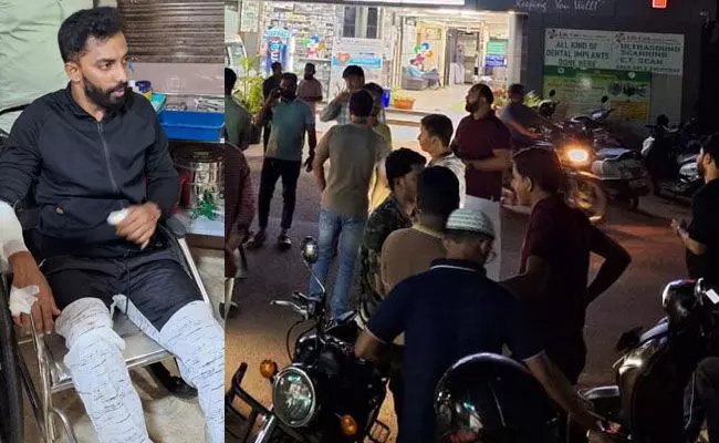 ಭಟ್ಕಳ: ಪ್ರವಾಸಿಗರ ಮೇಲೆ ಹಲ್ಲೆ; ದಂಪತಿಗೆ ಗಾಯ, ಪ್ರಕರಣ ದಾಖಲು