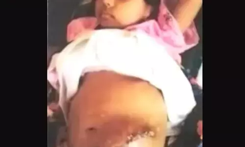 ಕಿಡ್ನಿ, ಅನ್ನನಾಳ, ಮಲದ್ವಾರ ಸಮಸ್ಯೆಯಿಂದ ಬಳಲುವ ತಂಝೀಮ್‌ಗೆ ನೆರವು ನೀಡಲು ಮನವಿ