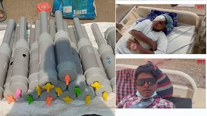 ಮಧ್ಯಪ್ರದೇಶ | ದೀಪಾವಳಿ ಸಂದರ್ಭದಲ್ಲಿ ʼಕಾರ್ಬೈಡ್ ಗನ್ʼ ಬಳಕೆ: 14 ಮಕ್ಕಳ ದೃಷ್ಟಿನಾಶ