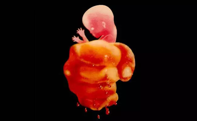 ಹೆಣ್ಣು ಜೀವ-ಎಳೆಯ ಭ್ರೂಣ ಮತ್ತು ಸಾಮಾಜಿಕ ಪ್ರಜ್ಞೆ ಹೆಣ್ಣು ಜೀವ-ಎಳೆಯ ಭ್ರೂಣ ಮತ್ತು ಸಾಮಾಜಿಕ ಪ್ರಜ್ಞೆ