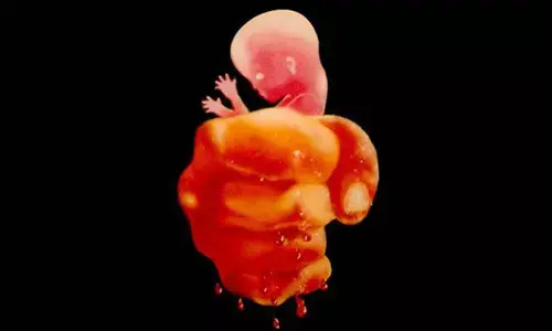 ಹೆಣ್ಣು ಜೀವ-ಎಳೆಯ ಭ್ರೂಣ ಮತ್ತು ಸಾಮಾಜಿಕ ಪ್ರಜ್ಞೆ