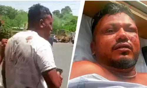 ಅಹಮದಾಬಾದ್ ವಿಮಾನ ದುರಂತ | ದುರಂತದಲ್ಲಿ ಬದುಕುಳಿದಿರುವ ಏಕೈಕ ಪ್ರಯಾಣಿಕ ಈಗ ಹೇಗಿದ್ದಾರೆ?