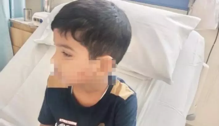 ಬಜ್ಪೆ:  6 ವರ್ಷದ ಬಾಲಕನ ಮೇಲೆ ಬೀದಿ ನಾಯಿ ದಾಳಿ