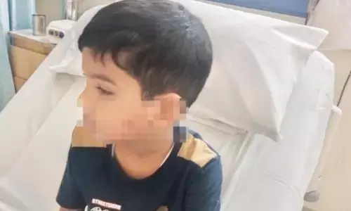 ಬಜ್ಪೆ:  6 ವರ್ಷದ ಬಾಲಕನ ಮೇಲೆ ಬೀದಿ ನಾಯಿ ದಾಳಿ