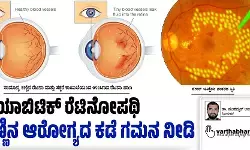 ಡಯಾಬಿಟಿಕ್ ರೆಟಿನೋಪಥಿ ಕಣ್ಣಿನ ಆರೋಗ್ಯದ ಕಡೆ ಗಮನ ನೀಡಿ