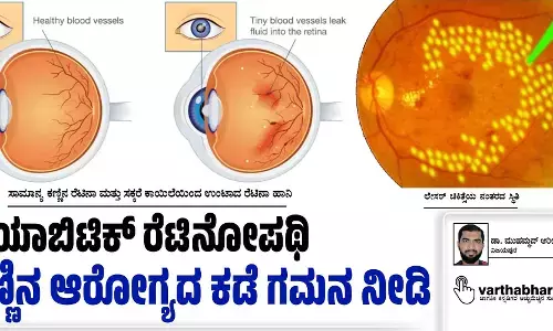 ಡಯಾಬಿಟಿಕ್ ರೆಟಿನೋಪಥಿ ಕಣ್ಣಿನ ಆರೋಗ್ಯದ ಕಡೆ ಗಮನ ನೀಡಿ