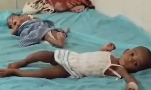 ಬುಡಕಟ್ಟು ಪ್ರದೇಶಗಳಲ್ಲಿ ಅಪೌಷ್ಟಿಕತೆಯಿಂದ ಶಿಶು ಮರಣ: ಲೋಕಸಭೆಯಲ್ಲಿ ಉತ್ತರಿಸದೆ ನುಣುಚಿಕೊಂಡ ಕೇಂದ್ರ ಸರಕಾರ