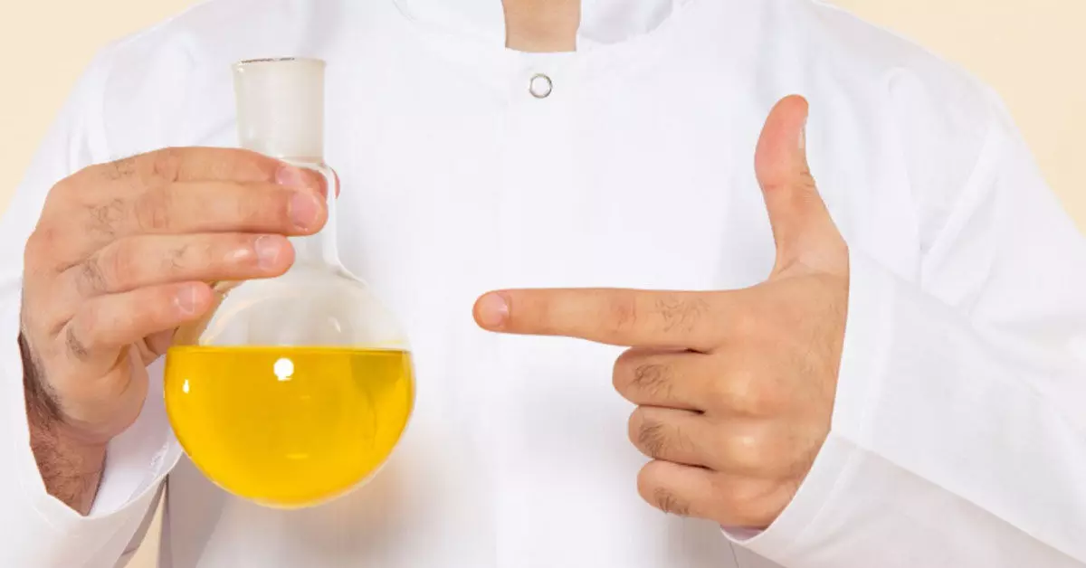 ಸಂಸ್ಕರಿಸಿದ ಎಣ್ಣೆಯಿಂದಷ್ಟೇ ಬೊಜ್ಜು ಬರುವುದಿಲ್ಲ! ಸಂಸ್ಕರಿಸಿದ ಎಣ್ಣೆಯಿಂದಷ್ಟೇ ಬೊಜ್ಜು ಬರುವುದಿಲ್ಲ!