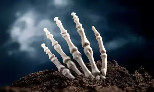 ಉಡುಪಿ | ಅಪರಿಚಿತ ಗಂಡಸಿನ ಅಸ್ಥಿಪಂಜರ ಪತ್ತೆ