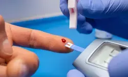 LDL ಕೊಲೆಸ್ಟರಾಲ್ ಪರೀಕ್ಷೆಯನ್ನು ಸಣ್ಣ ವಯಸ್ಸಿನಲ್ಲೇ ಮಾಡಿಸಬೇಕೇ?