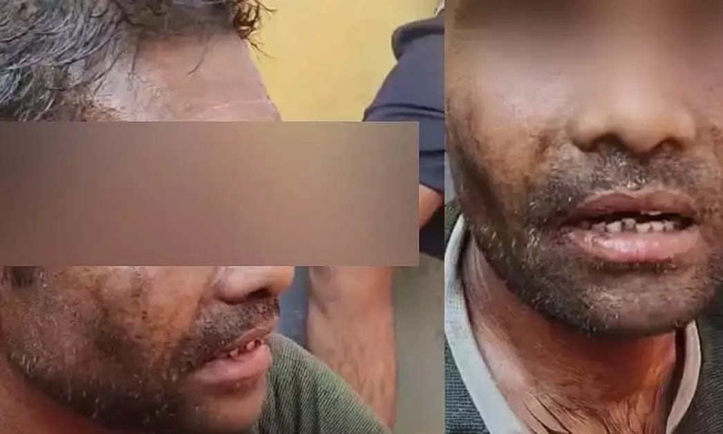 ಕೇರಳ ಗುಂಪು ಹತ್ಯೆ ಪ್ರಕರಣ: ಮೃತದೇಹ ಸ್ವೀಕರಿಸಲು ನಿರಾಕರಿಸಿದ ಸಂತ್ರಸ್ತನ ಕುಟುಂಬ