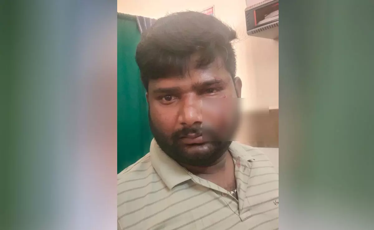 ಚಿಕ್ಕಬಳ್ಳಾಪುರ| ದಲಿತ ಯುವಕನ ಮೇಲೆ ಹಲ್ಲೆ : ಪ್ರಕರಣ ದಾಖಲು ಚಿಕ್ಕಬಳ್ಳಾಪುರ| ದಲಿತ ಯುವಕನ ಮೇಲೆ ಹಲ್ಲೆ : ಪ್ರಕರಣ ದಾಖಲು