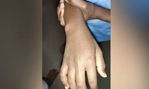 ಯಾದಗಿರಿ | ಶಿಕ್ಷಕಿಯಿಂದ ವಿದ್ಯಾರ್ಥಿ ಮೇಲೆ ಹಲ್ಲೆ ಆರೋಪ : ಪೋಷಕರ ಆಕ್ರೋಶ