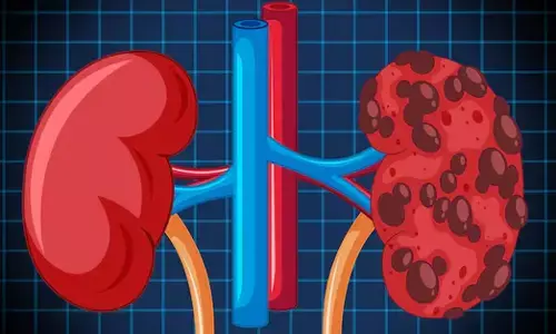ರಕ್ತದೊತ್ತಡದ ಔಷಧಿಗಳು ಕಿಡ್ನಿಗೆ ಸಮಸ್ಯೆ ಒಡ್ಡುತ್ತವೆಯೇ?