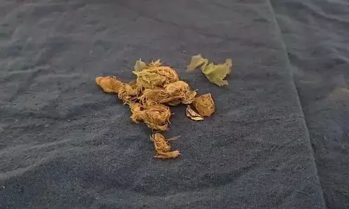 ಬೆಳ್ತಂಗಡಿ :  ಆಟವಾಡುತ್ತಿದ್ದ ವೇಳೆ  ಸ್ಫೋಟಕ ಸಿಡಿದು ಬಾಲಕನಿಗೆ ಗಾಯ