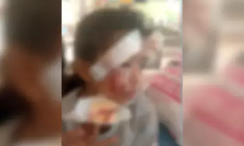 VITTAL | ಅಂಗನವಾಡಿಗೆ ತೆರಳುತ್ತಿದ್ದ ಮಗುವಿನ ಮೇಲೆ ಬೀದಿನಾಯಿ ದಾಳಿ: ತೀವ್ರ ಗಾಯ