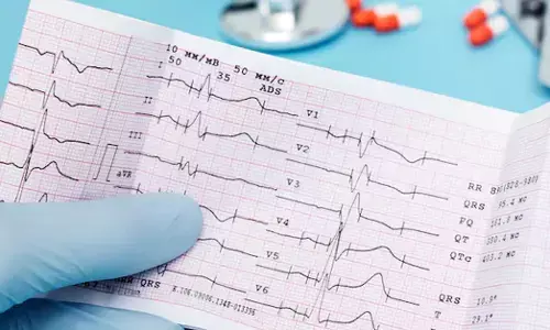 ECG ನಾರ್ಮಲ್ ಇದ್ದ ಮಾತ್ರಕ್ಕೆ ಹೃದಯ ಸೇಫ್ ಆಗಿದೆಯೆ? ವೈದ್ಯರು ಹೇಳುವುದೇನು?