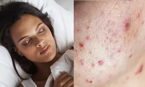 ಮೊಡವೆಯಿಂದ ಪ್ರಾರಂಭಿಸಿ ನಿದ್ರೆಯವರೆಗೆ ಕರುಳಿನ ಆರೋಗ್ಯದ 7 ಚಿಹ್ನೆಗಳನ್ನು ಕಡೆಗಣಿಸಬೇಡಿ…